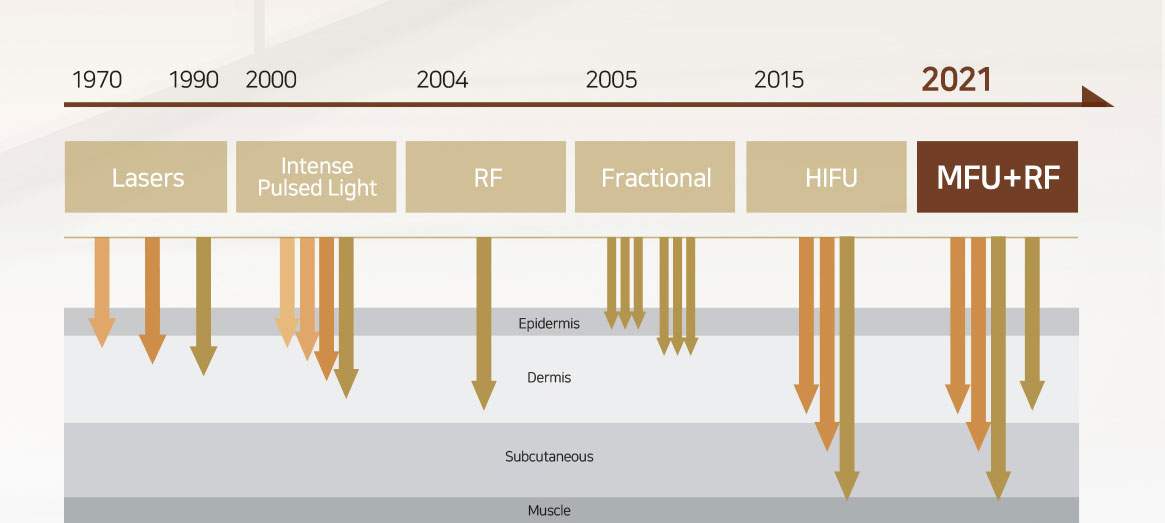 Xu hướng công nghệ nâng cơ trẻ hóa da MFU, vượt trội hơn HIFU
