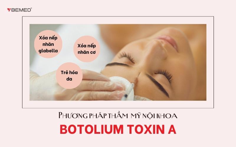 Botulinum toxin A