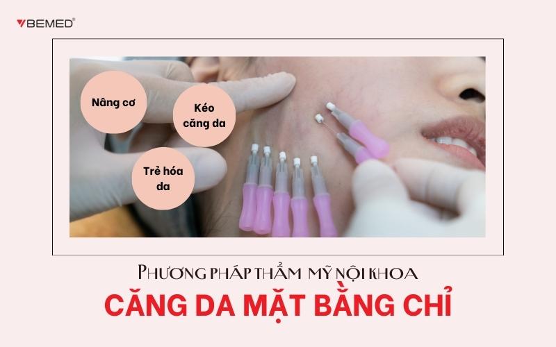 Căng chỉ da mặt