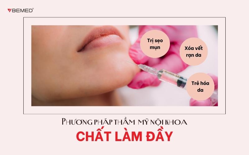 Chất làm đầy