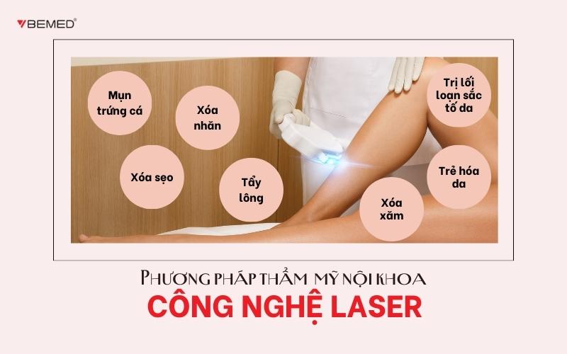 Công nghệ Laser